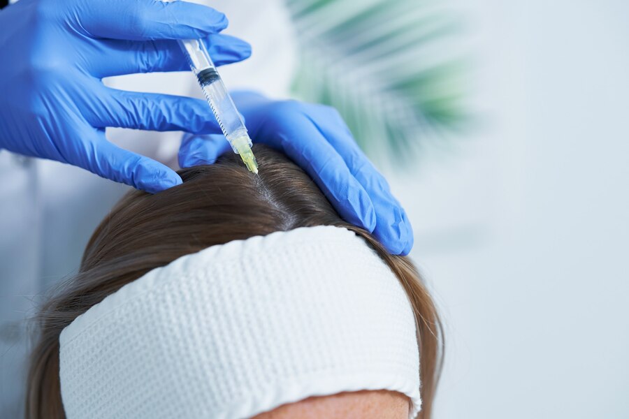 PRP Hair Treatment in Karachi
